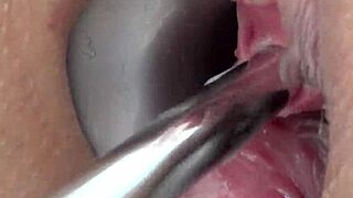 mature milf endures intense german electro torment