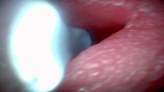 Endoscope Camera Captures Moment of Male Ejaculation with Cum Swapping