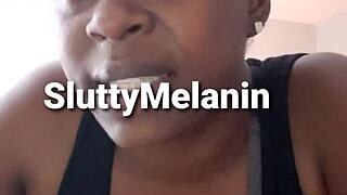 Penial Yeast Infection In Ebony Milf Amateur