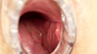 Milf Nurse In Uniform Performs Bizarre Close Up Self Exam